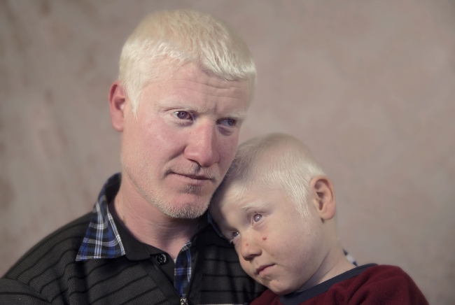 Türkiye’nin beyaz melekleri